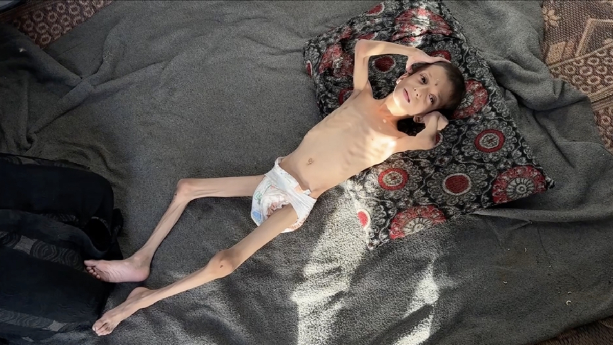 israilin kitliga surukledigi 10 yasindaki nafiz kemik yiginina donustu 4rpckJmY